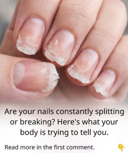 Weak or Brittle Nails: What Your Body Is Trying to Tell You