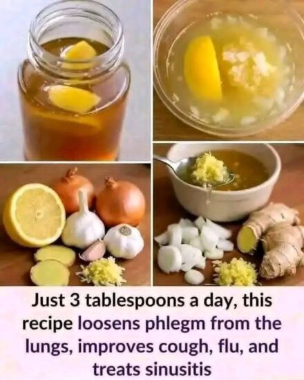 The Ultimate Home Remedy: Lemon Juice, Honey, Garlic, Onion, and Grated Ginger