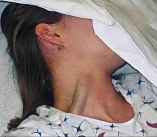 Snoring While Sleeping: A Symptom of Something More Serious?