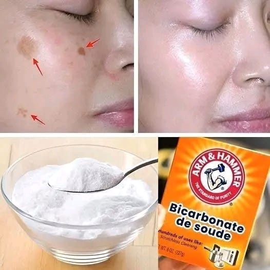 4 Ways to Erase Age Spots with Baking Soda for Younger, More Even Skin