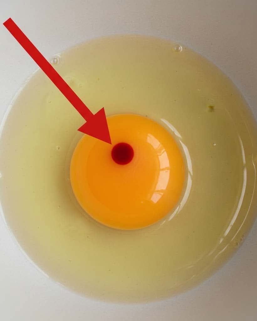 I Found Red Spots in My Eggs — Are They Safe to Eat or Should I Throw Them Away?