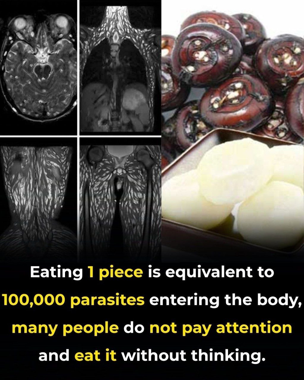 Eating Just One Bite Can Be Harmful: How to Protect Yourself from Foodborne Parasites