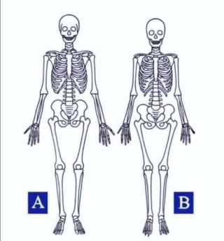Which one is a woman???