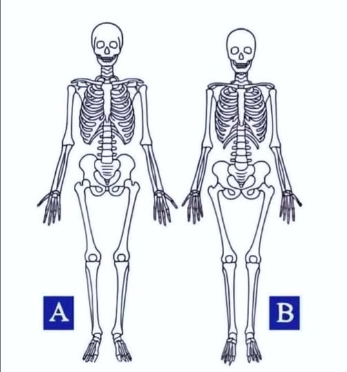 Which one is a woman???